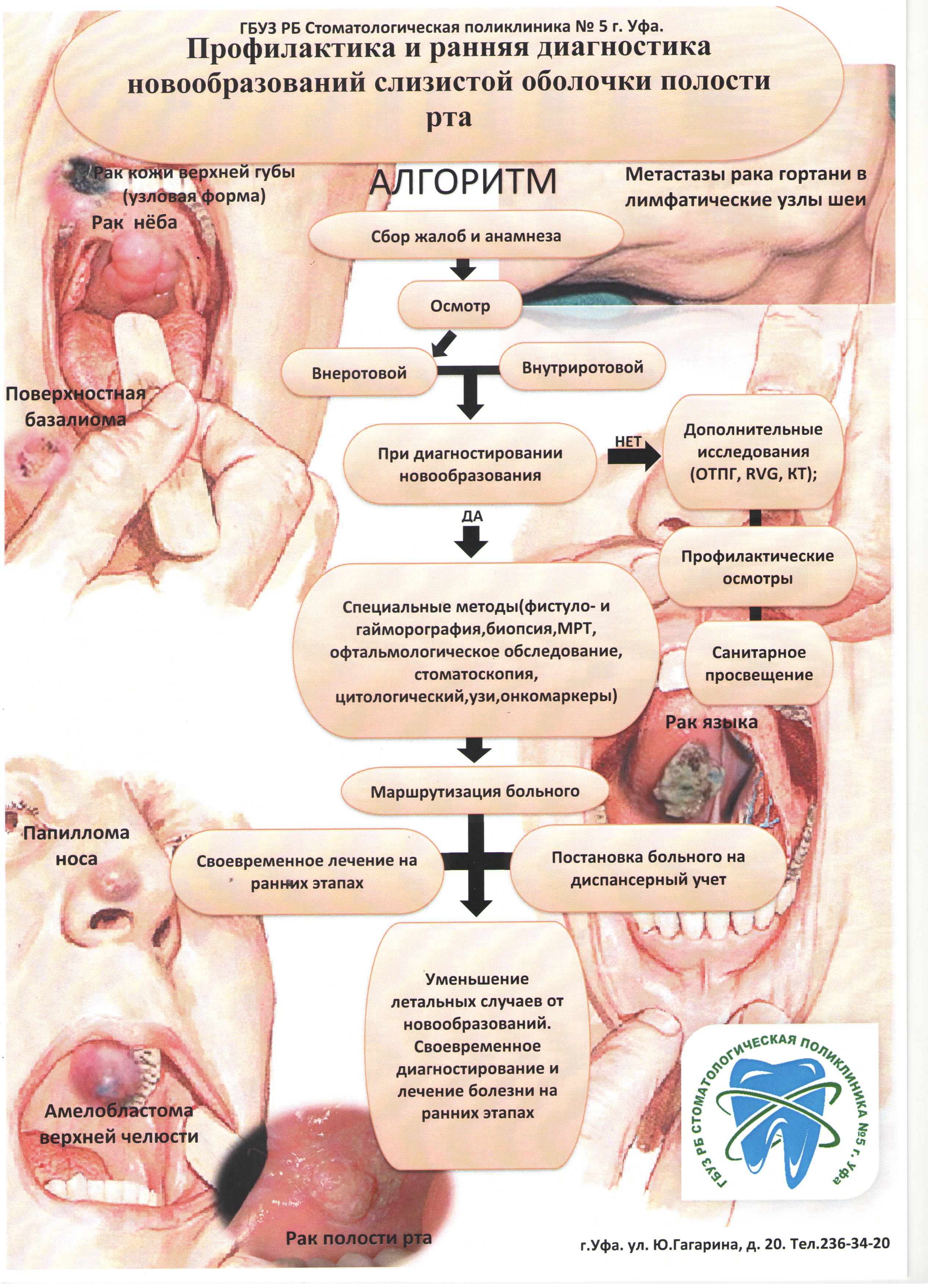 Профилактика и рання диагностика новообразований слизистой оболочки полости  рта